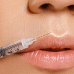 The Truth Behind Cosmetic Procedures: How Many ML in a Syringe of Filler?
